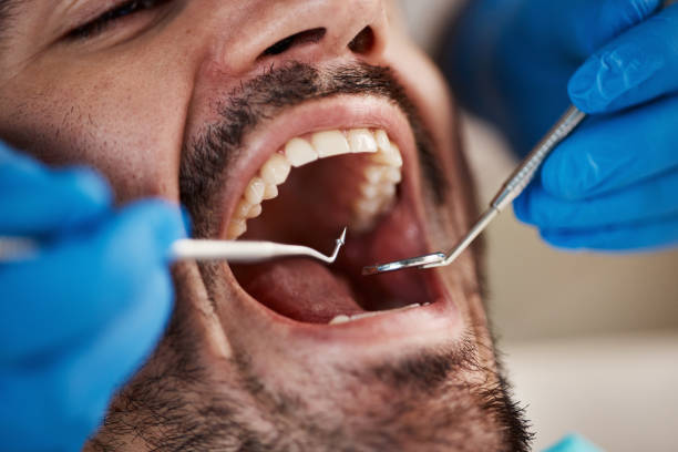 Best Teeth Whitening  in Onarga, IL